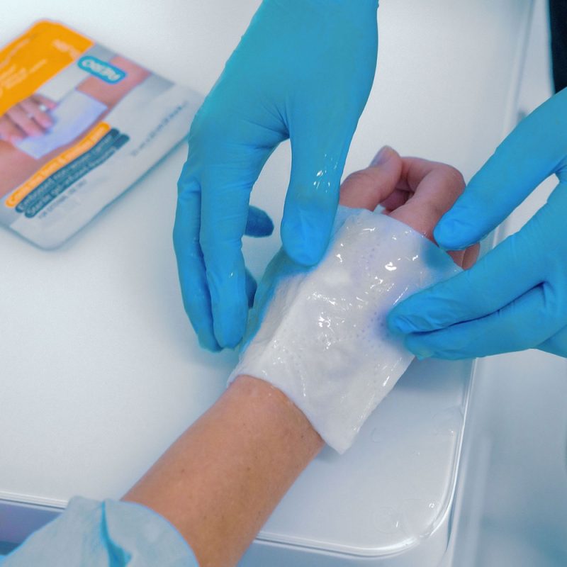 Burn Gel Dressing, 20 x 20cm - Image 2
