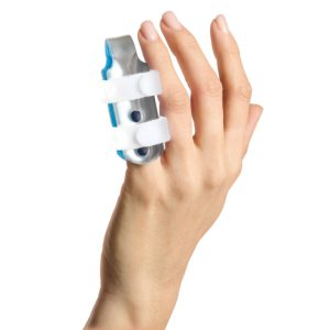 Splints